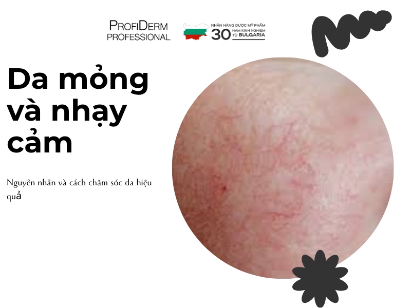 Nguyên Nhân Da Mỏng, Yếu Khiến Da Nhạy Cảm Và Cách Chăm Sóc