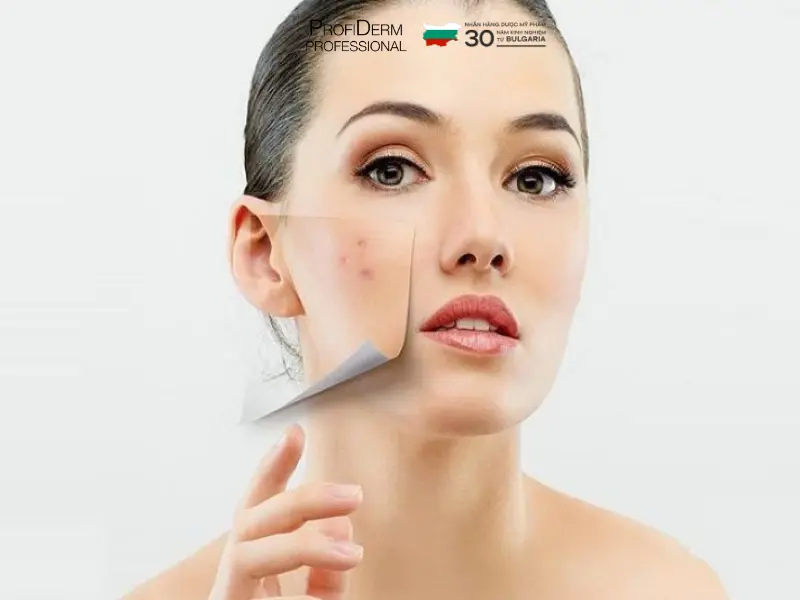 các hoạt chất trị thâm đỏ