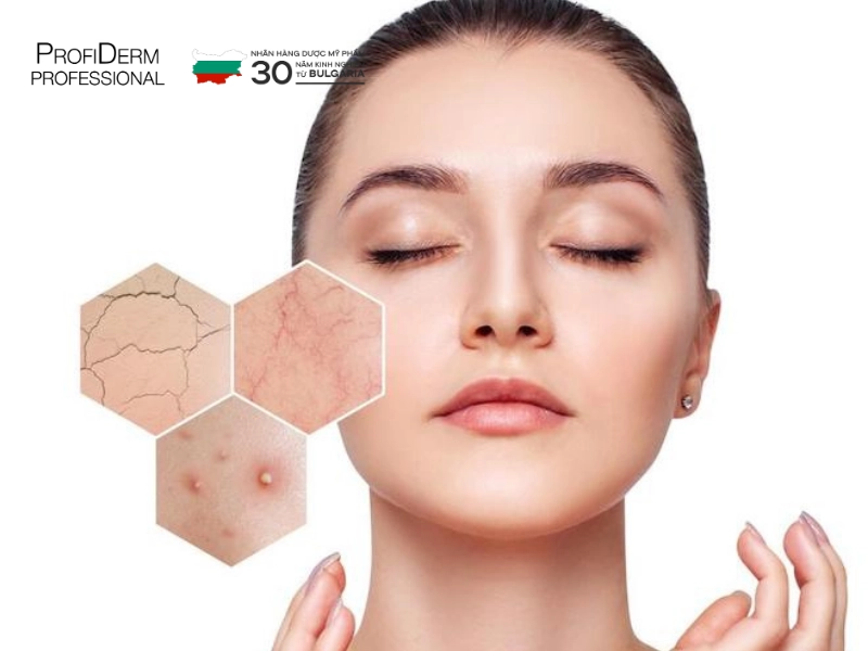 kem dưỡng ẩm cho da nhạy cảm