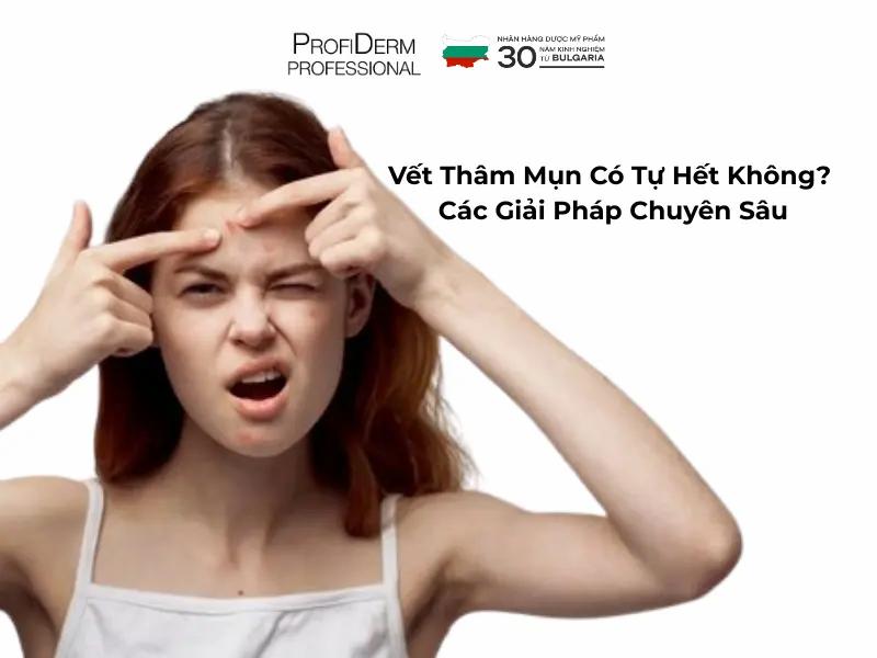 Vết Thâm Mụn Có Tự Hết Không? Các Giải Pháp Chuyên Sâu
