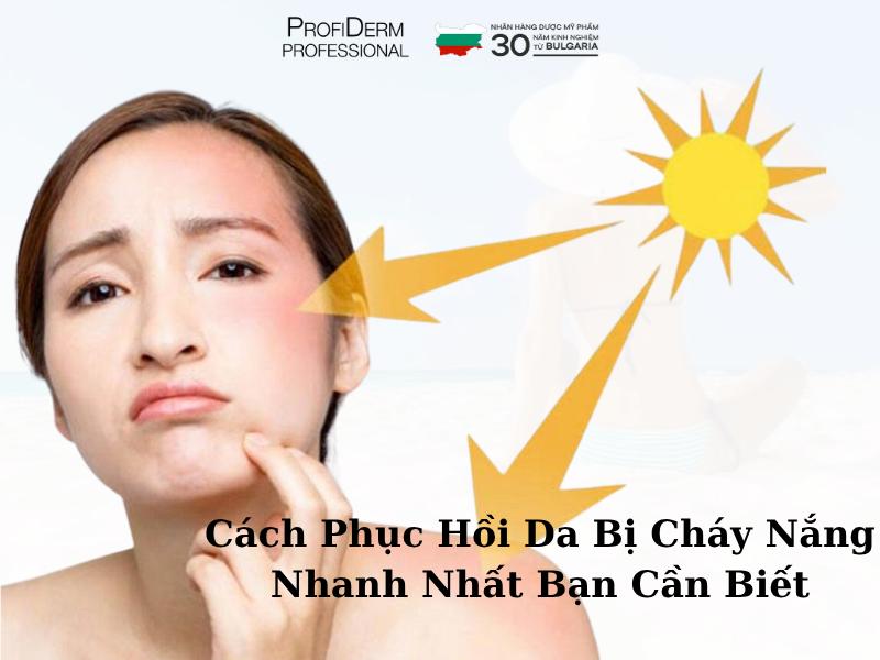 #Cách Phục Hồi Da Bị Cháy Nắng Nhanh Nhất Bạn Cần Biết