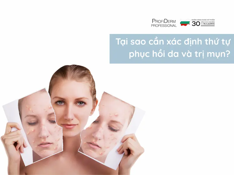 nên phục hồi da trước hay trị mụn trước