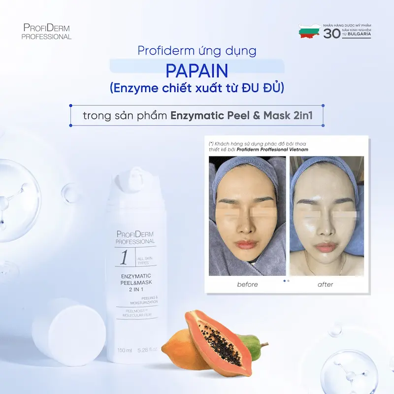 Phục hồi da nhiễm corticoid nặng