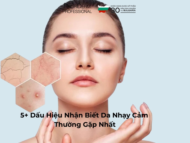 5+ Dấu Hiệu Nhận Biết Da Nhạy Cảm Thường Gặp Nhất