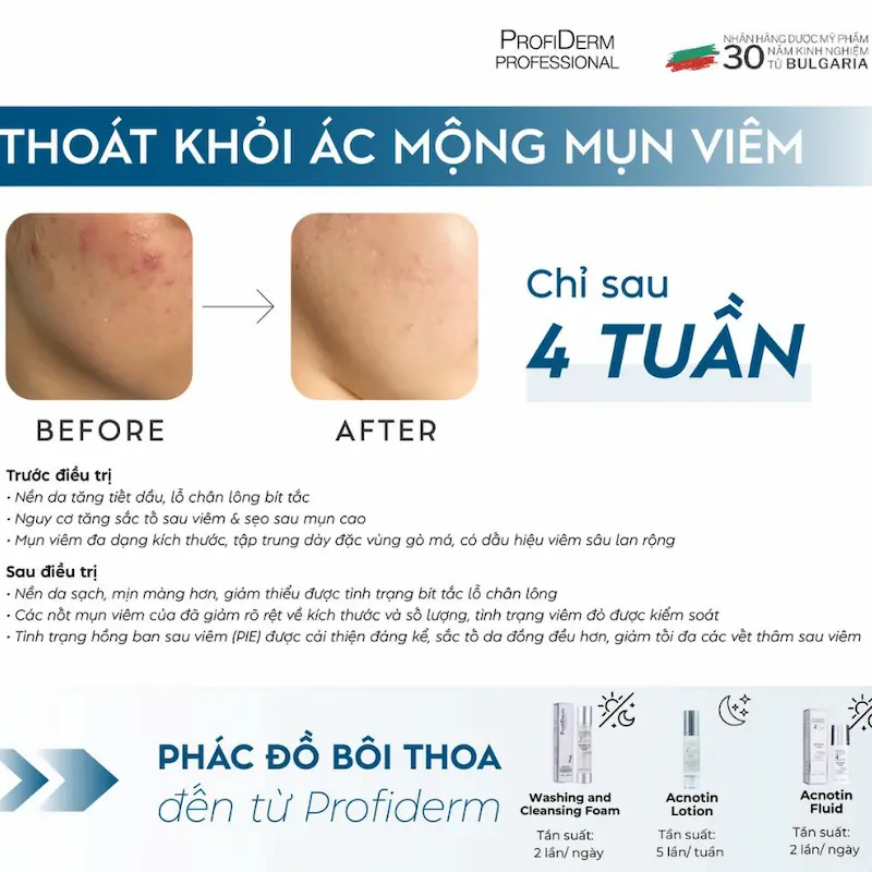 Gợi ý sản phẩm phục hồi da từ Profiderm