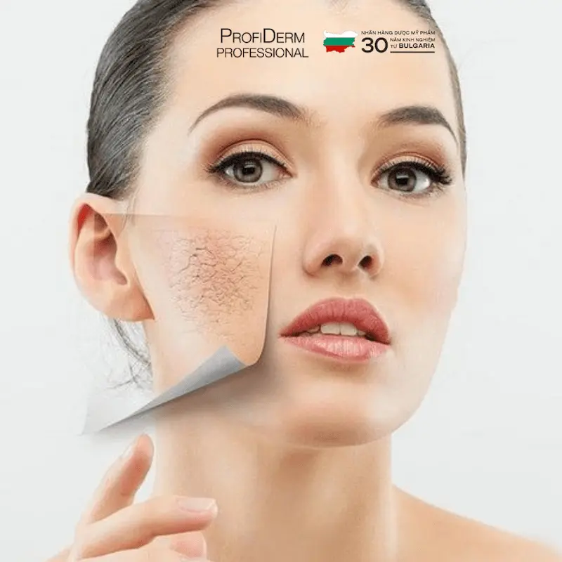 phục hồi da sau peel
