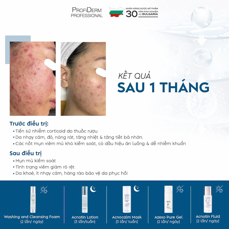 Công dụng vượt trội của Azexo Pure Gel cho làn da