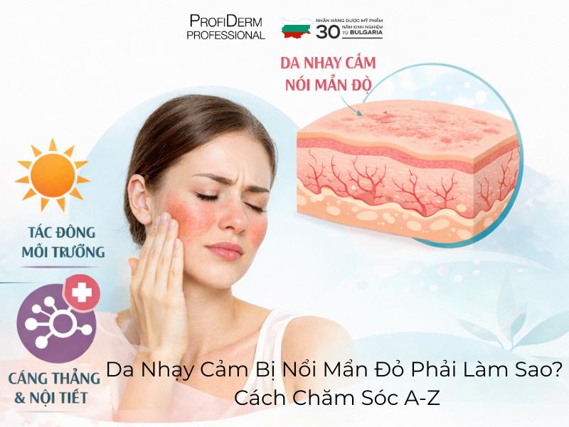 Da Nhạy Cảm Bị Nổi Mẩn Đỏ Phải Làm Sao? Cách Chăm Sóc A-Z