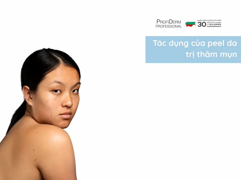 Tác Dụng Của Peel Da Trị Thâm Mụn