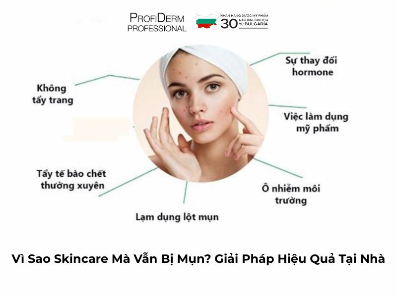 Vì Sao Skincare Mà Vẫn Bị Mụn? Giải Pháp Hiệu Quả Tại Nhà