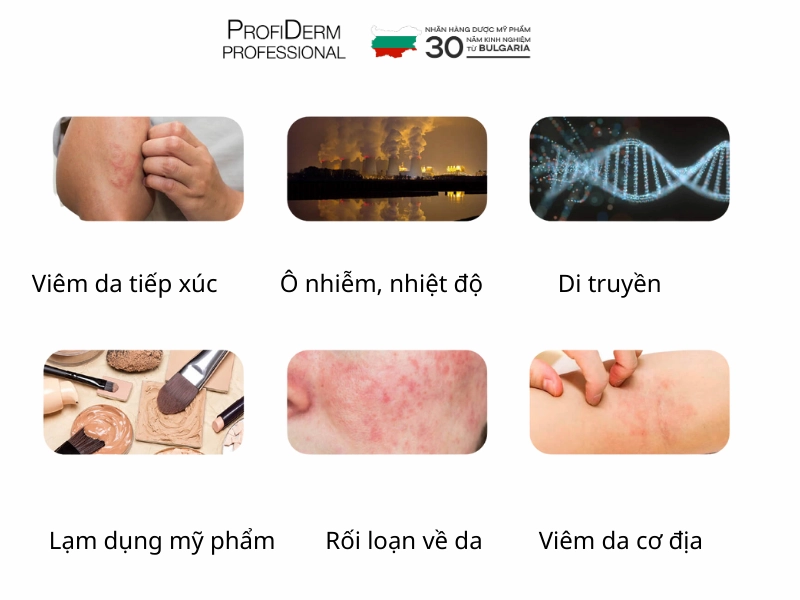 Các yếu tố gây ra hoặc làm trầm trọng thêm tình trạng da nhạy cảm