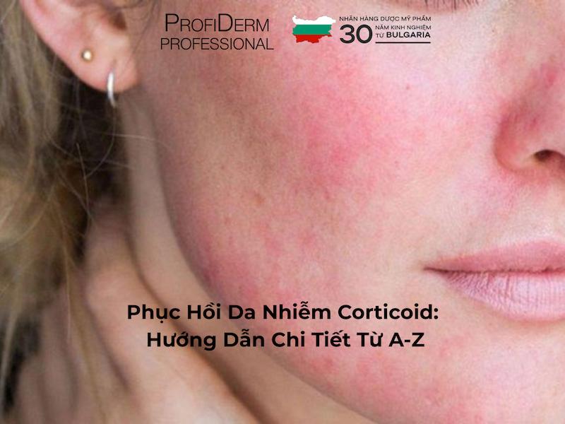 Phục Hồi Da Nhiễm Corticoid: Hướng Dẫn Chi Tiết Từ A-Z