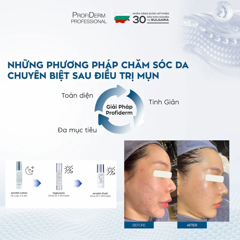 phục hồi da yếu đỏ