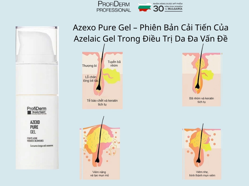 Azexo pure gel