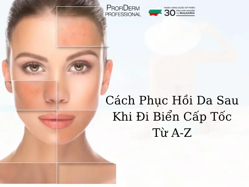 cách phục hồi da sau khi đi biển