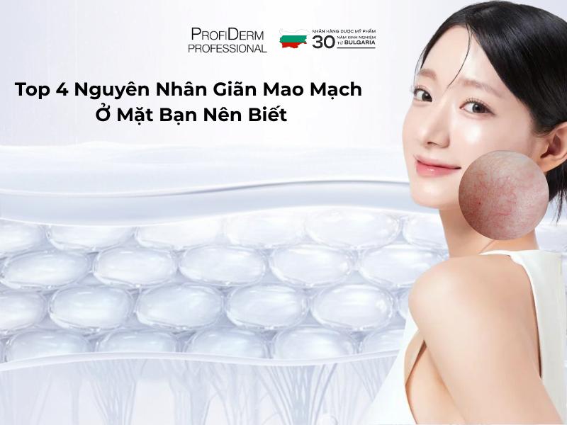 Top 4 Nguyên Nhân Giãn Mao Mạch Ở Mặt Bạn Nên Biết
